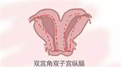 北京代生全包多少钱，胚胎移植数量跟试管成功率有什么关联？
